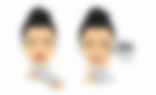 合肥奥美整形医院怎么预约