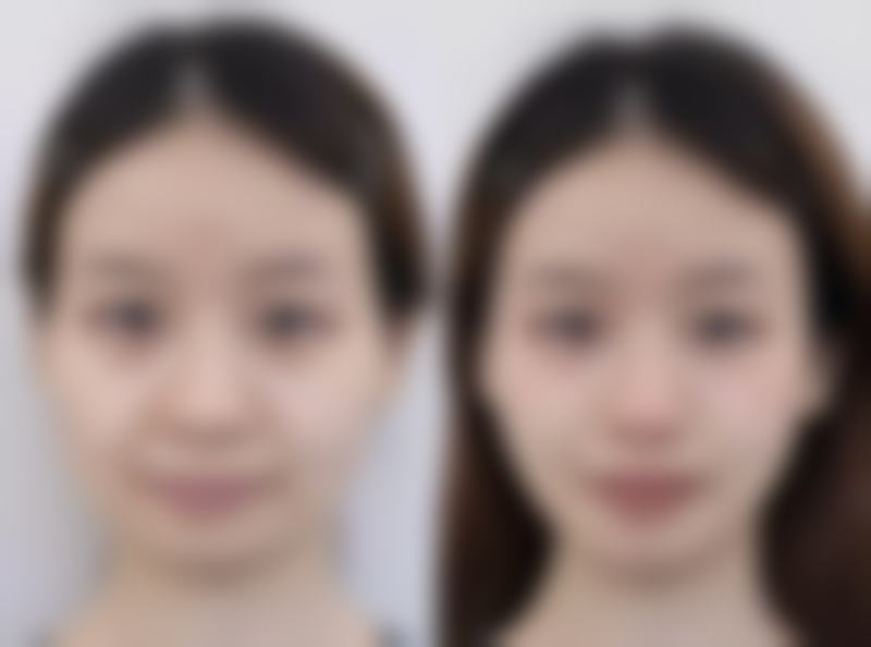 无锡舒安医疗美容诊所口碑评价怎么样？