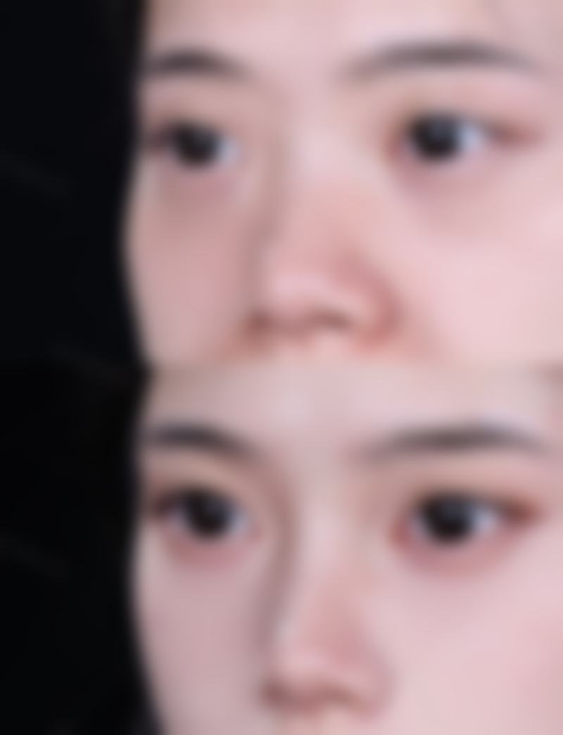 翼城小美微针整形医院基本信息