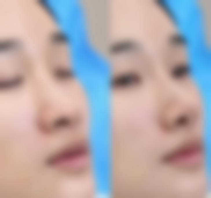 无锡舒安医疗美容诊所正规吗？