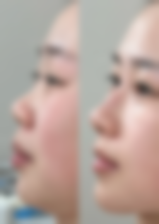 温州韩美整形美容医院怎么预约