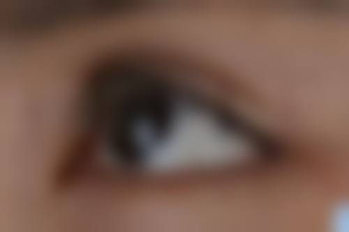 南昌俏佳人医疗美容门诊部刘善医生患者评价