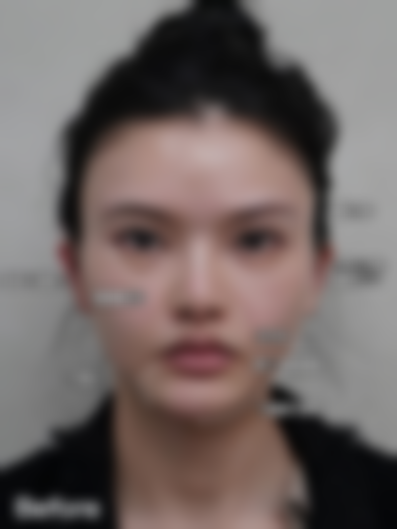 西安艺星医疗美容医院付麟凤的学术影响力排名