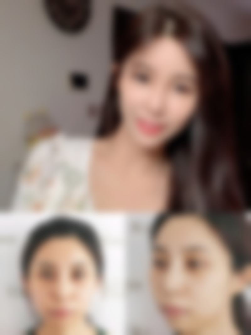 合肥伊微尚医疗美容门诊部怎么预约