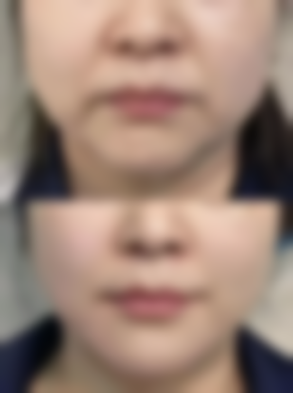 深圳腋秀腋臭医疗门诊部正规吗？