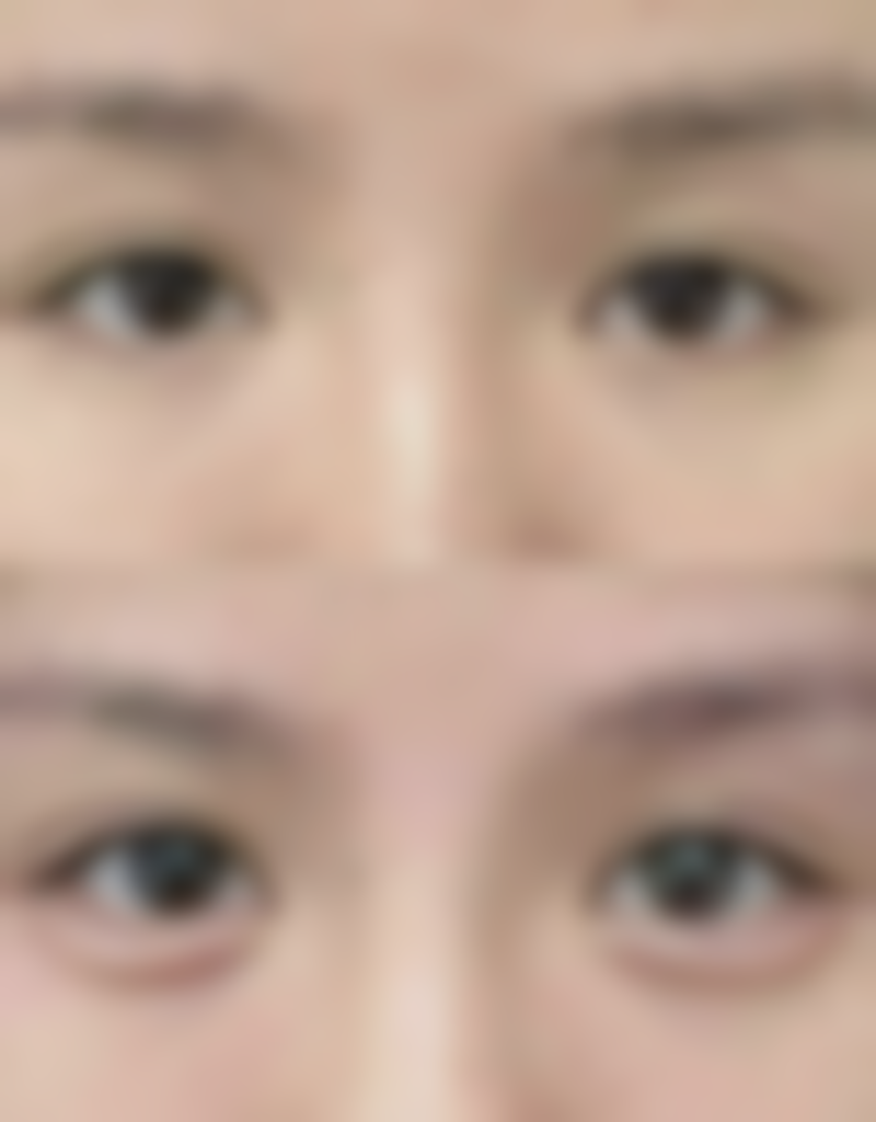 南昌俏佳人医疗美容门诊部刘善医生擅长项目