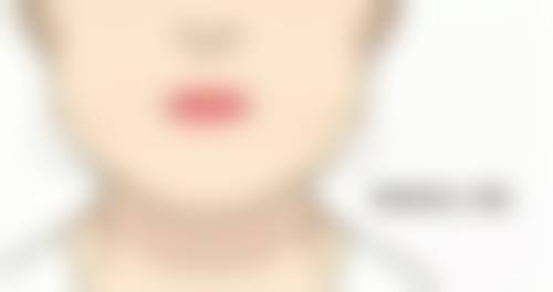 成都格莱丽整形医院吕光全医生预约挂号指南