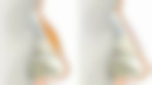 河南大学附属南石医院烧伤整形美容中 心李天宇医生收费价格