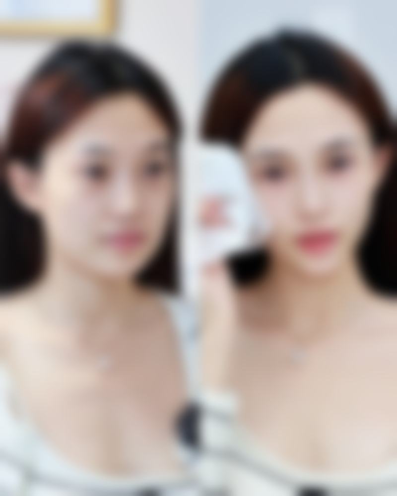 韩国MIND整形外科张慧媛医生患者评价