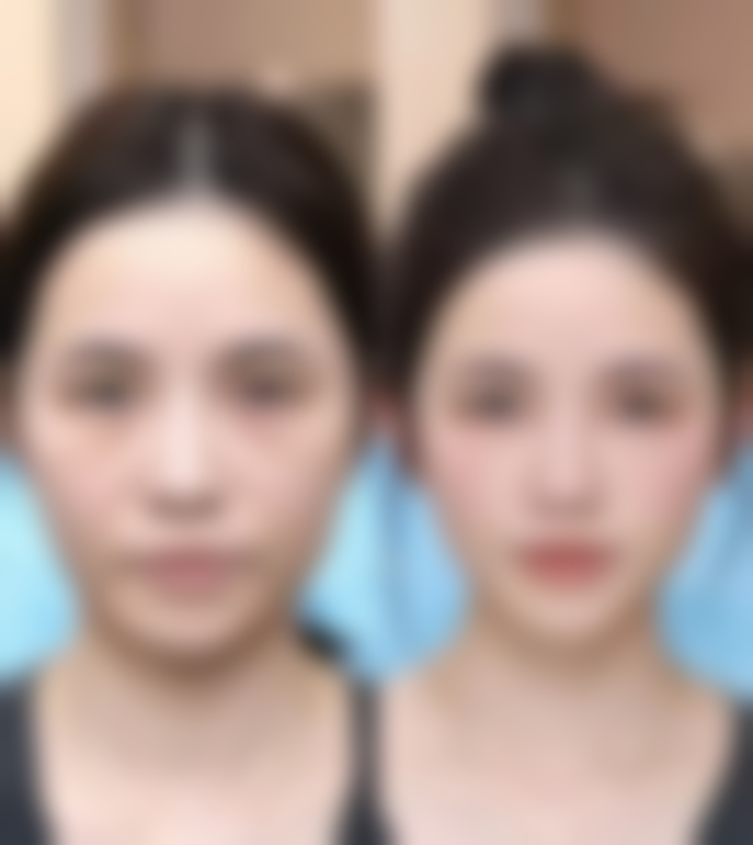 河南大学附属南石医院烧伤整形美容中 心李天宇医生擅长项目