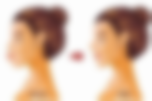 杭州冰美医疗美容廖宗源医生患者评价