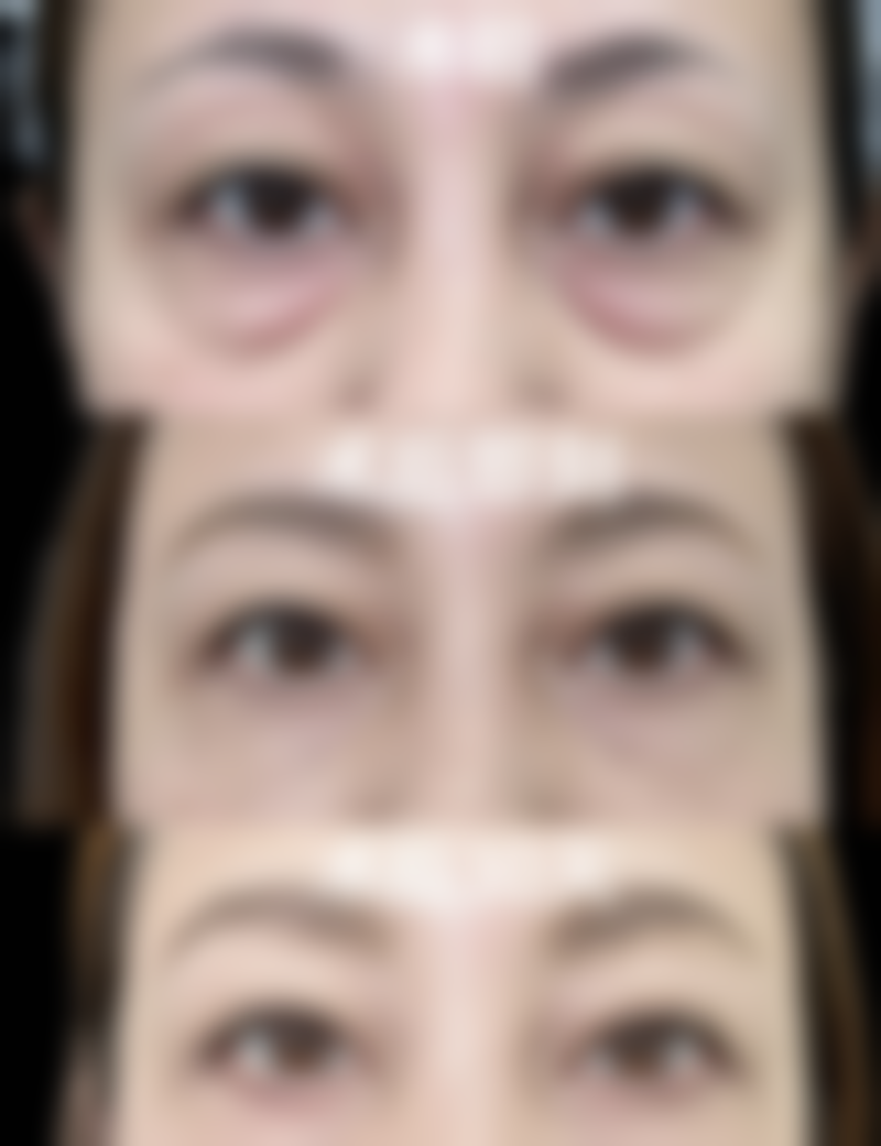 济南美尔雅整形美容诊所陈世俊医生中西结合治疗色斑技术怎么样？