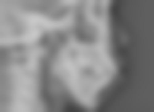 河南大学附属南石医院烧伤整形美容中 心张伟峰医生收费价格