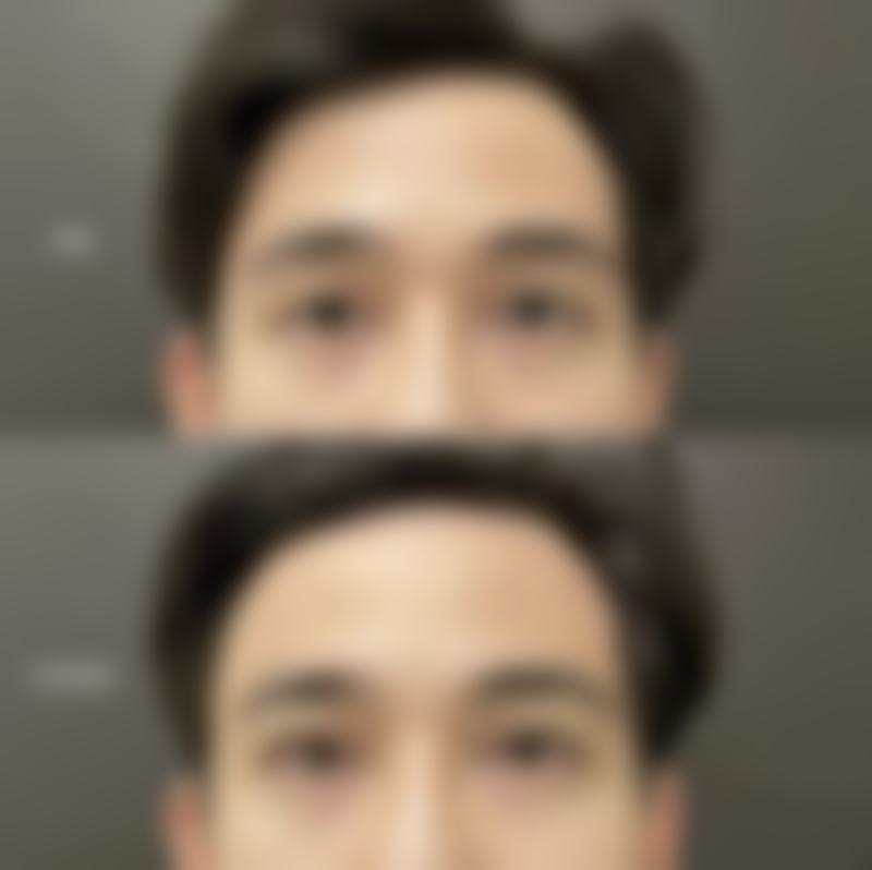 福州隆美尔医疗美容门诊部郭永年医生预约挂号指南