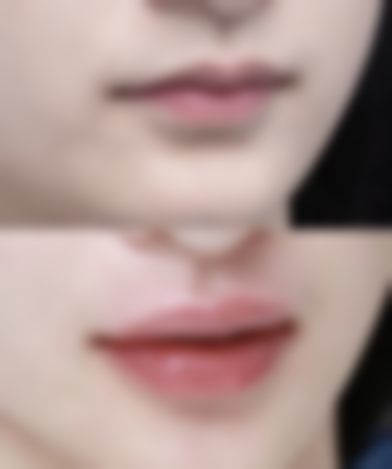 青州市人民医院美容科正规吗？