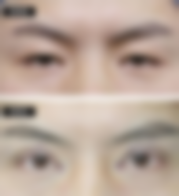 杭州雪然慕兮医疗美容诊所李少锋医生预约挂号指南