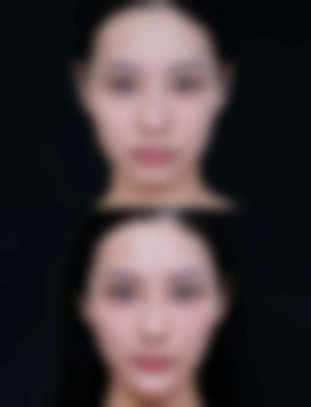 郑州佑尔美整形医院怎么预约