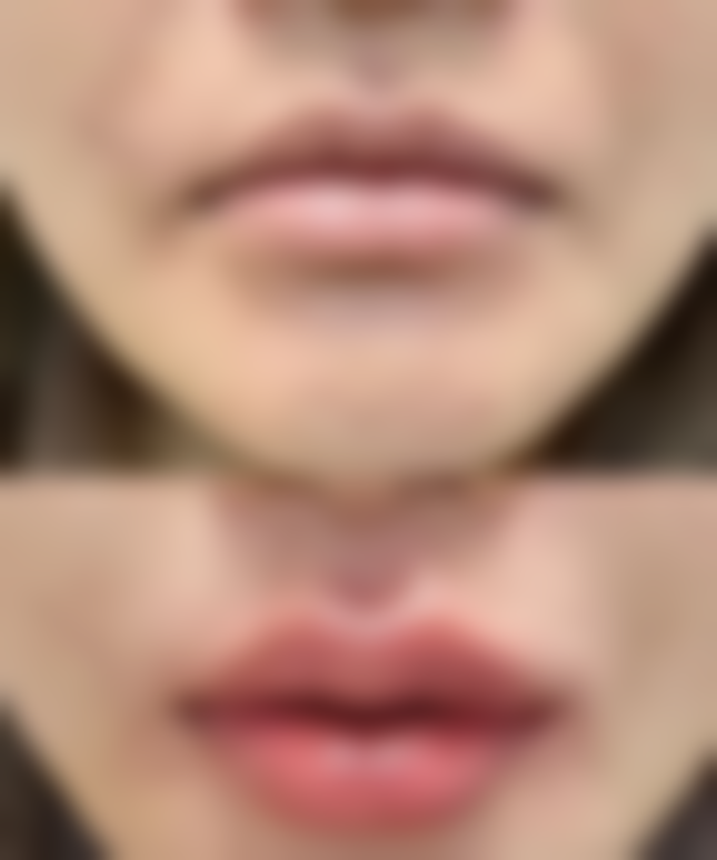 杭州雪然慕兮医疗美容诊所李少锋医生擅长项目