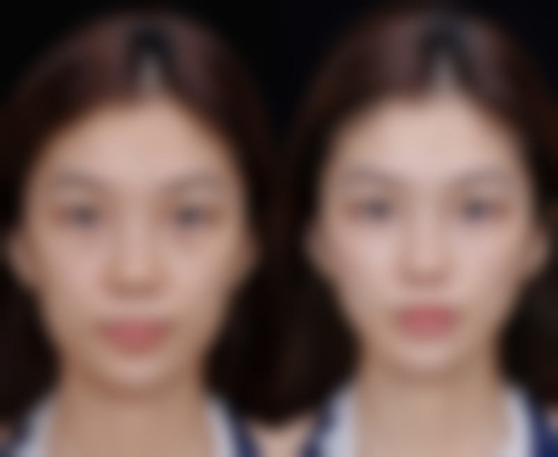 承德韩博仕医疗美容诊所怎么预约