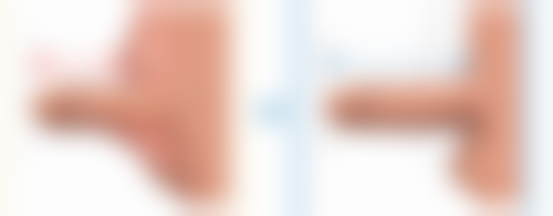 济南美尔雅整形美容诊所史利医生擅长项目