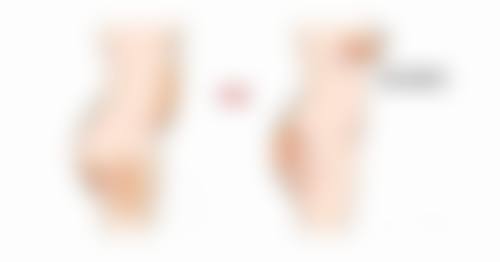 济南美尔雅整形美容诊所史利医生鼻整形技术怎么样？