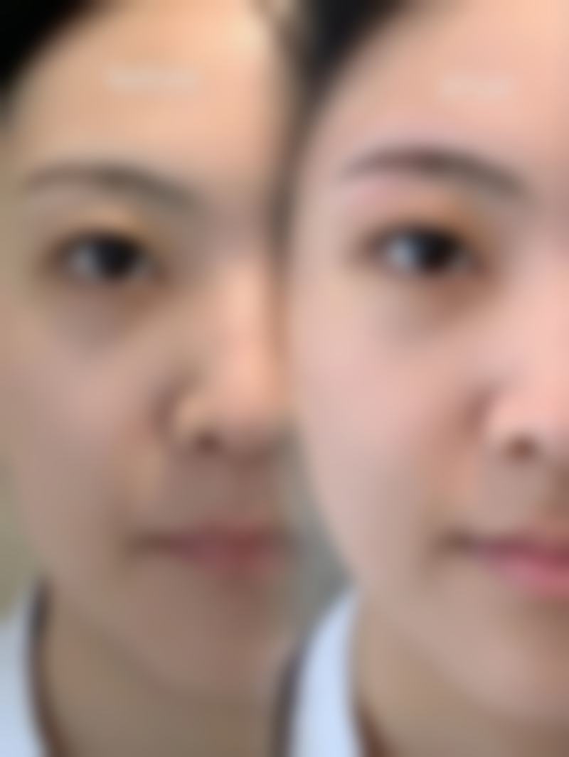 新疆千禧丽人整形美容医院潘丽红医生预约挂号指南