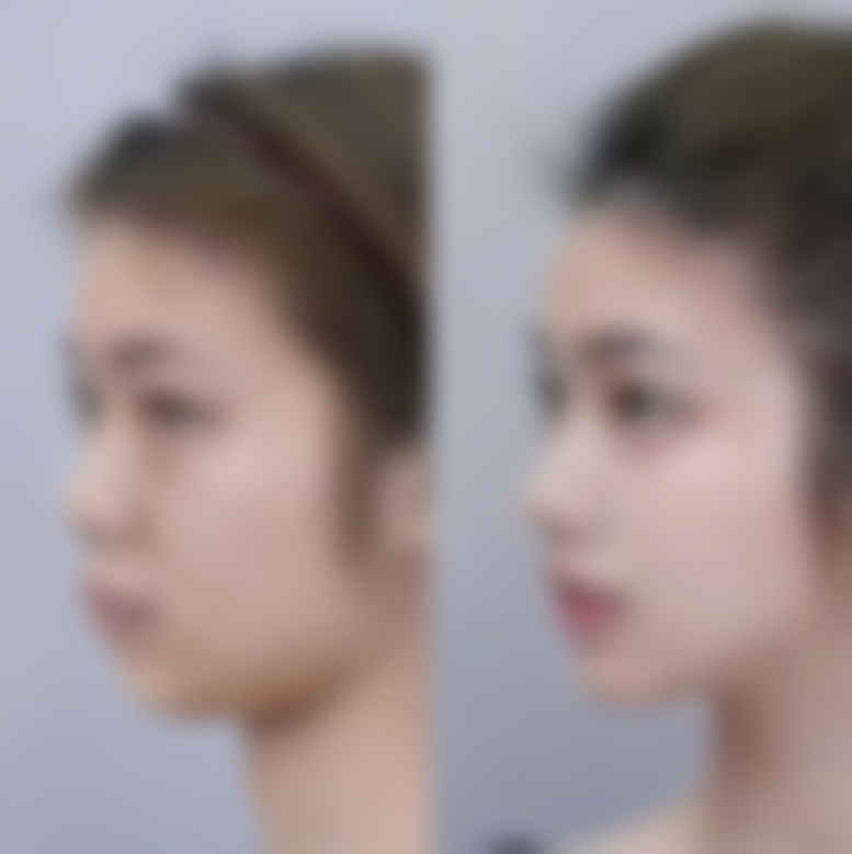 新疆千禧丽人整形美容医院潘丽红医生擅长项目