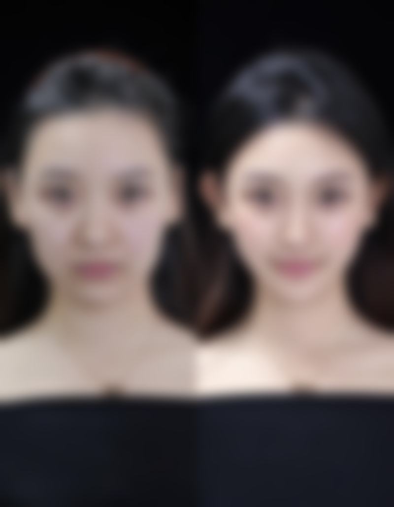 北京斯凯丽雅医疗美容诊所黄杰微医生患者评价