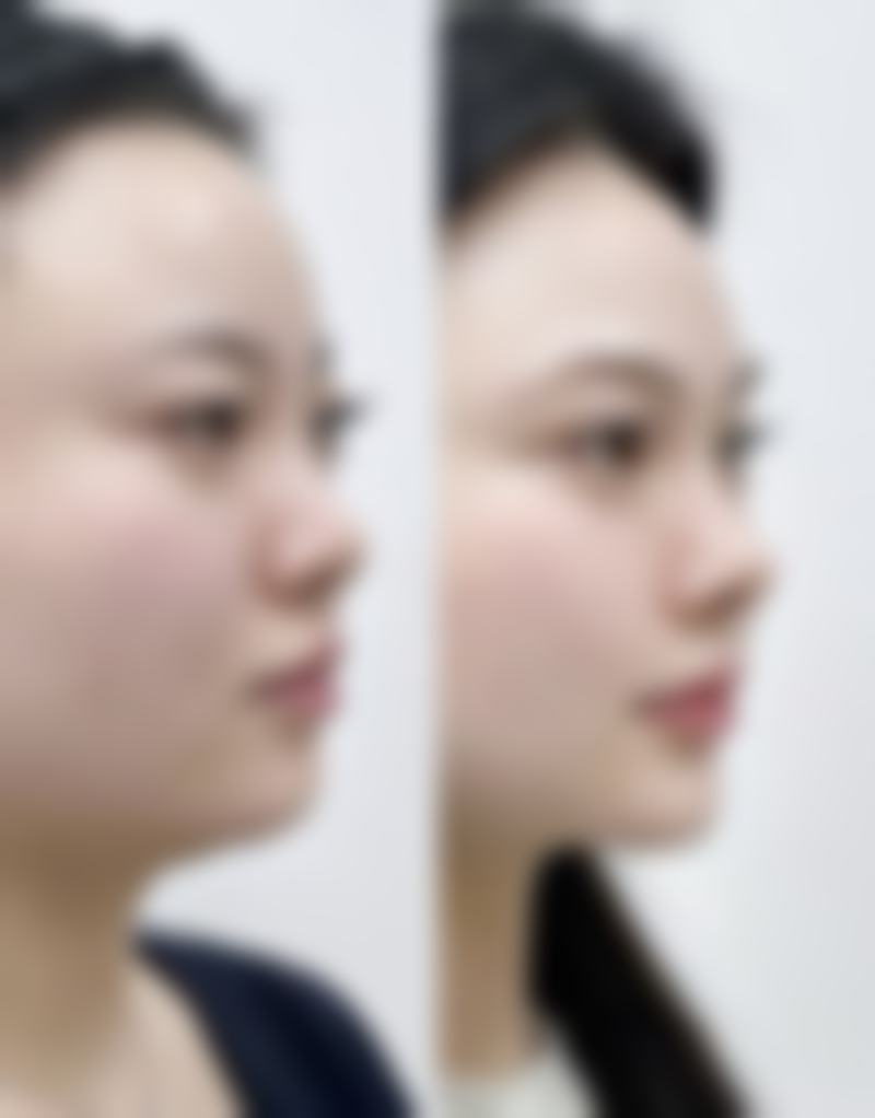 北京仁雁医疗美容门诊部王显伦医生收费价格