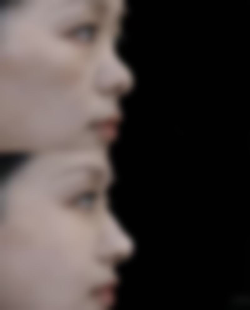 丽江美柏瑞美容医院陈取权医生水动力吸脂瘦大腿技术怎么样？