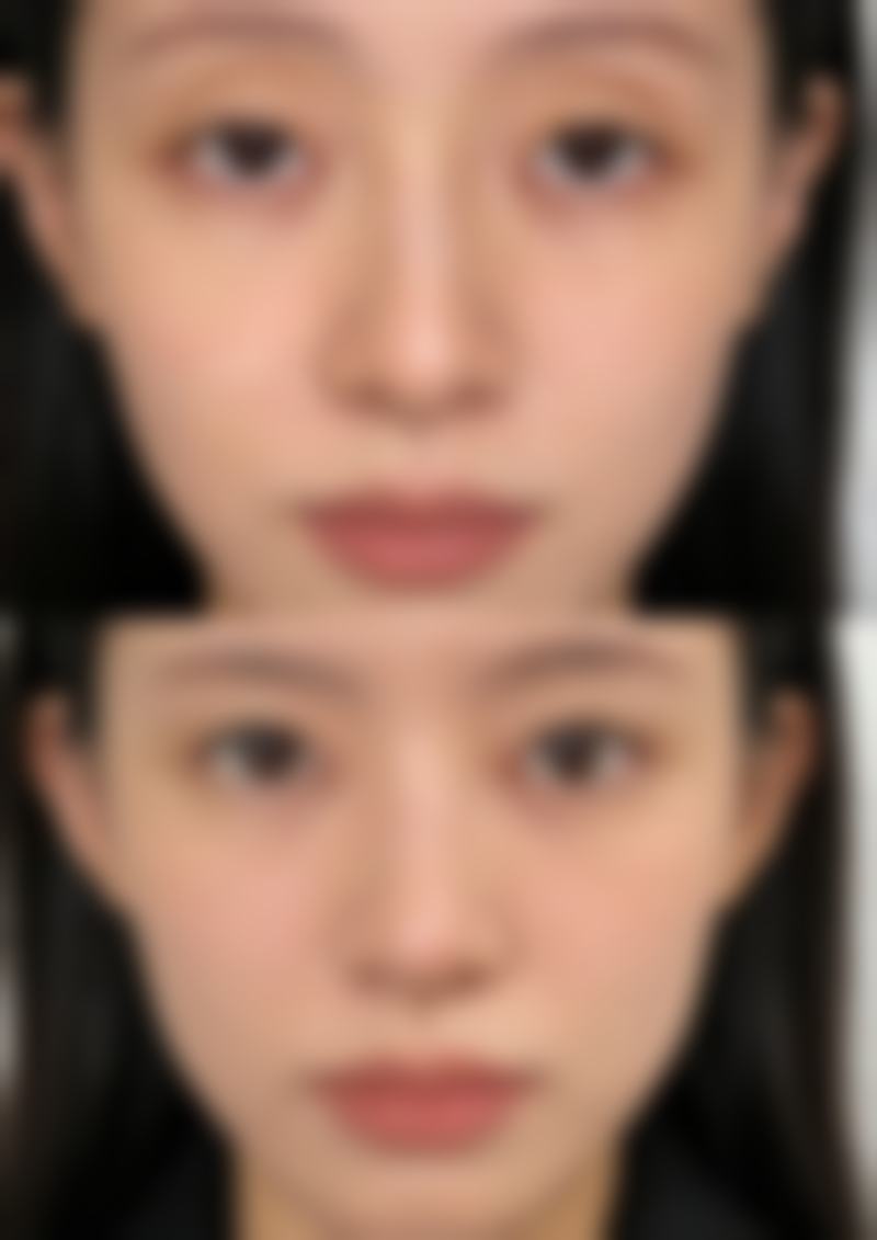 新疆千禧丽人整形美容医院潘丽红医生收费价格