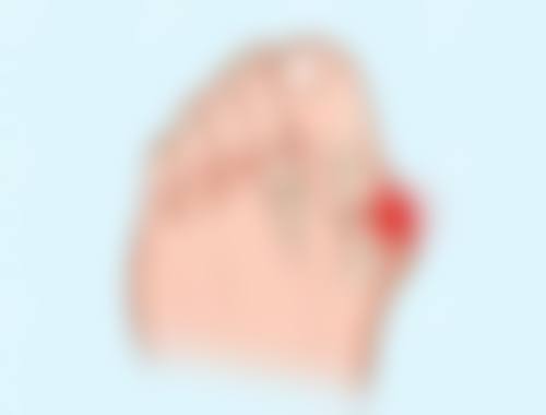 北京博士园植发门诊部周晚香医生预约挂号指南