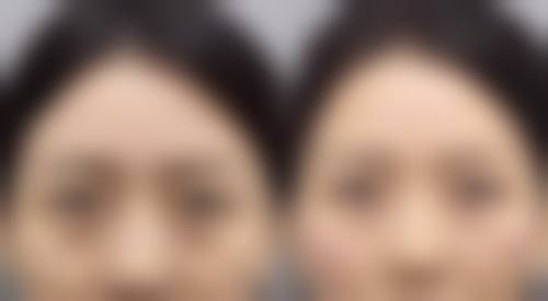 湘雅常德医院整形美容烧伤皮肤科怎么预约