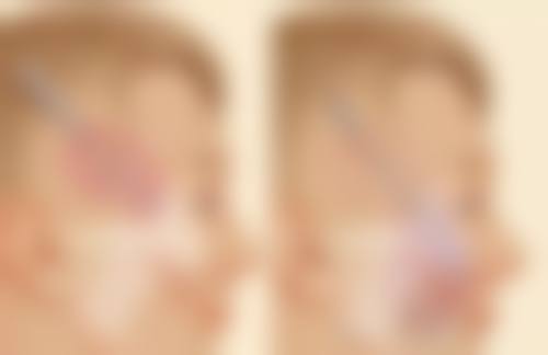 浙江杭州宁波菁漾医疗美容诊所口碑评价怎么样？