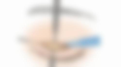 北京名媛芊丽整形医疗美容诊所口碑评价怎么样？