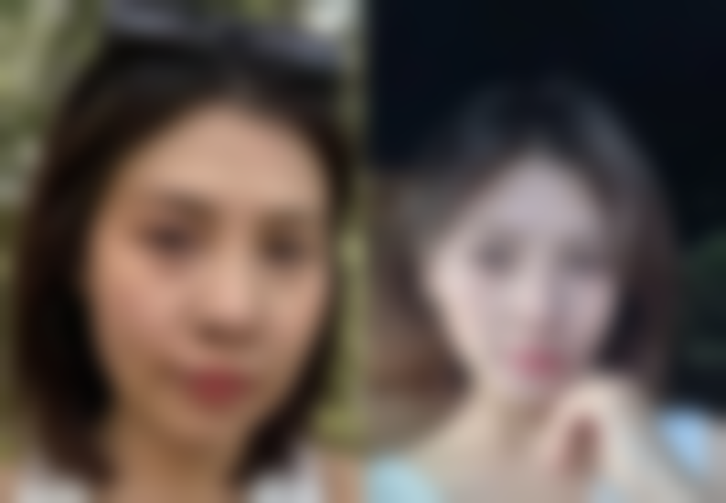 西安薇界医疗美容诊所口碑评价怎么样？