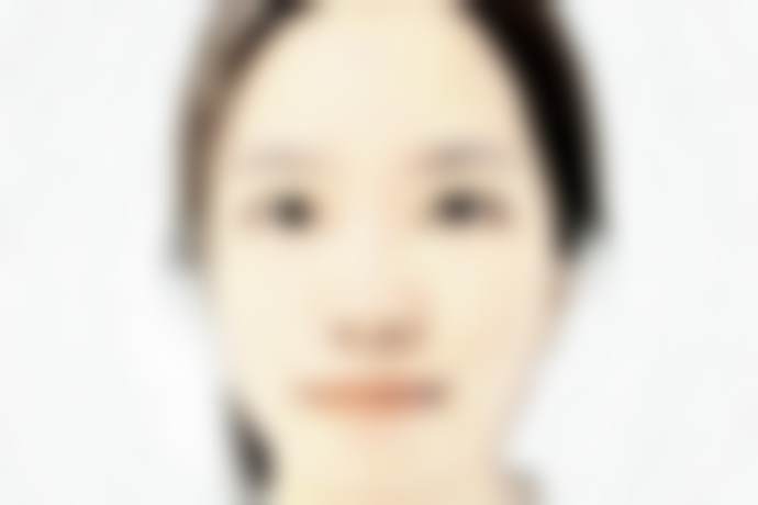 鞍山燕丽美容医院王葛医生隆胸技术怎么样？