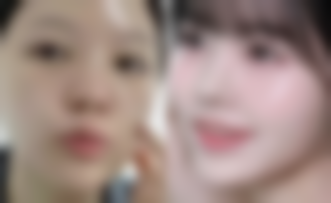 长沙艾依美医疗美容门诊部金鹏医生预约挂号指南