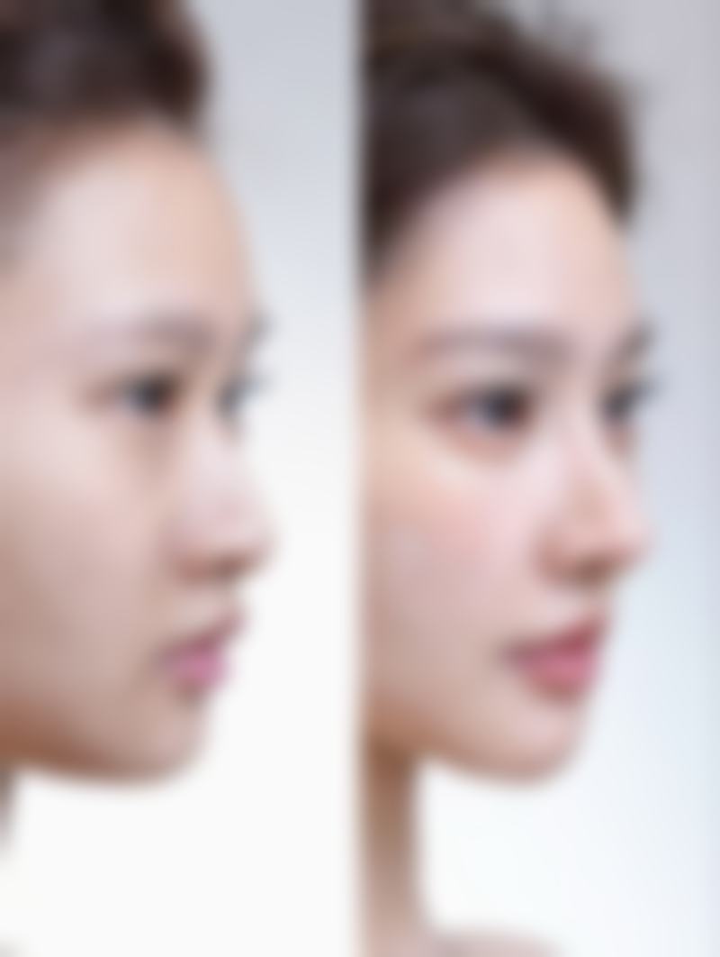 太原晋绮医疗美容诊所洪欣瑜医生微整形技术怎么样？