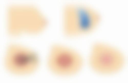 长沙雅美医疗美容医院王少甫医生患者评价