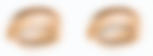 长沙雅美医疗美容医院何玮医生患者评价