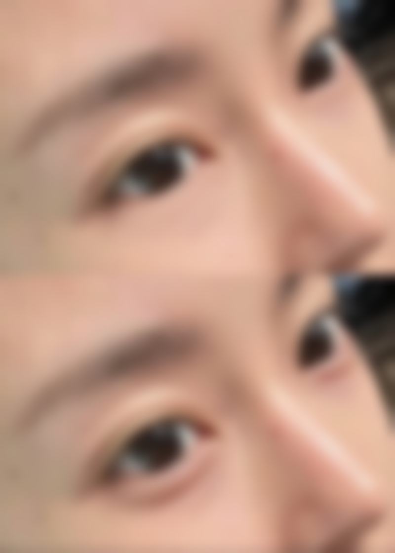 龙港颐正整形医院夏秉成医生预约挂号指南