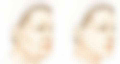 眉县赫丽森医疗美容诊所口碑评价怎么样？