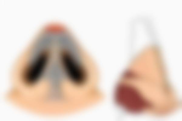 深度揭秘：北京蕾士悦容医疗美容门诊部张兵医生与渠道医生的区别