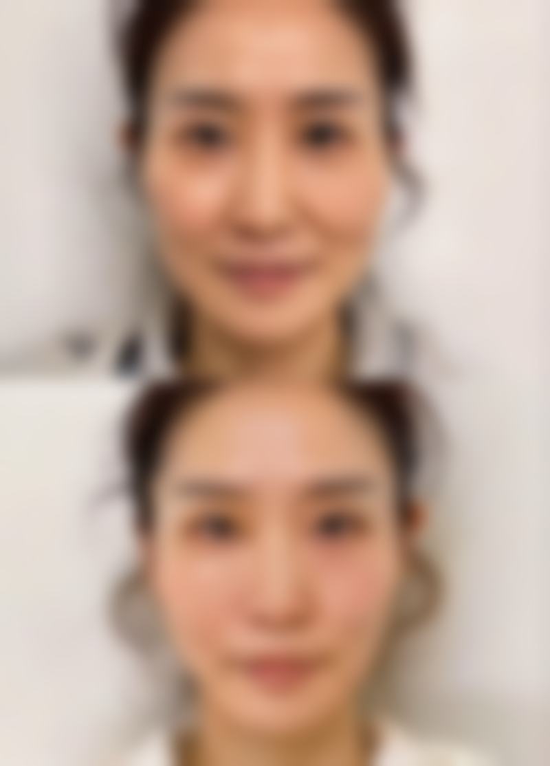 三亚爱丽丝医疗美容诊所正规吗？