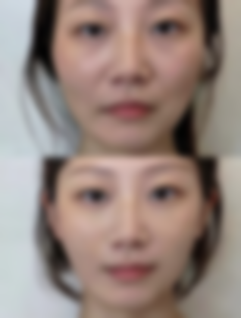 昆明金尚整形医院口碑评价怎么样？