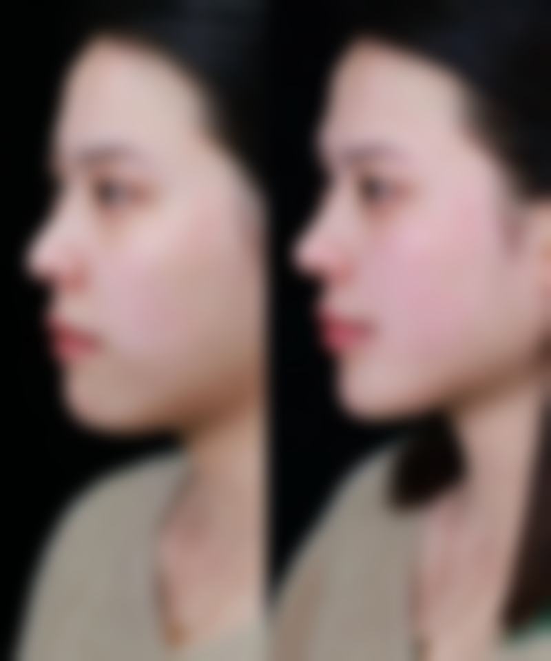 安徽亳州康美整形正规吗？