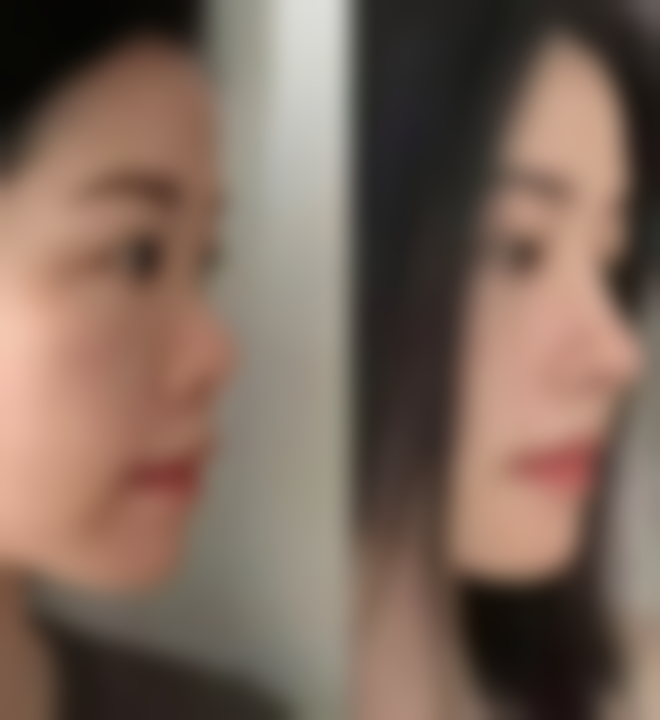 无锡美呈整形医疗美容门诊部口碑评价怎么样？