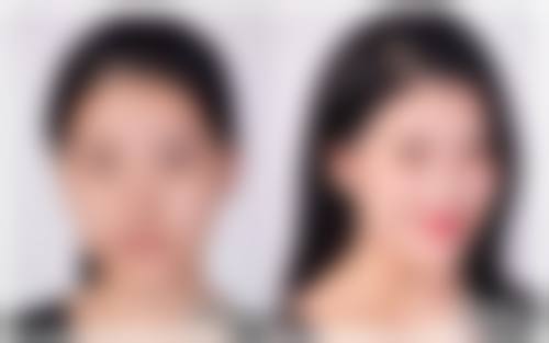 东阳玥莱美整形医院口碑评价怎么样？