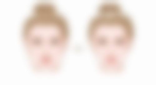 韩国棒棒整形外科口碑评价怎么样？